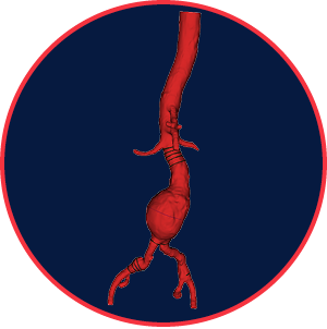 feature-aorta