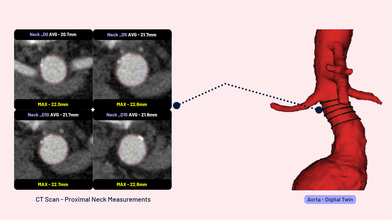 features-aorta-top features-aorta-top